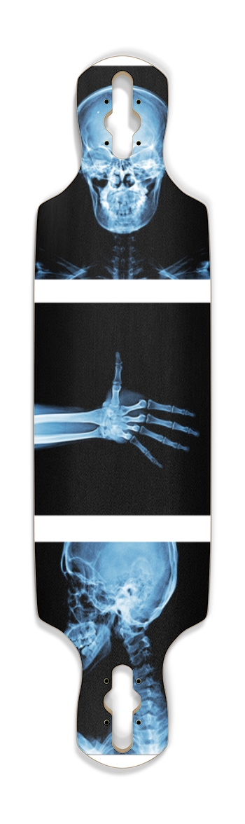 X-Ray