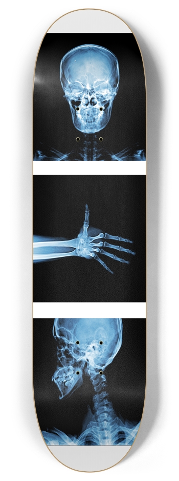 X-Ray