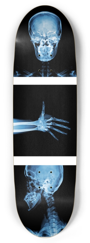 X-Ray