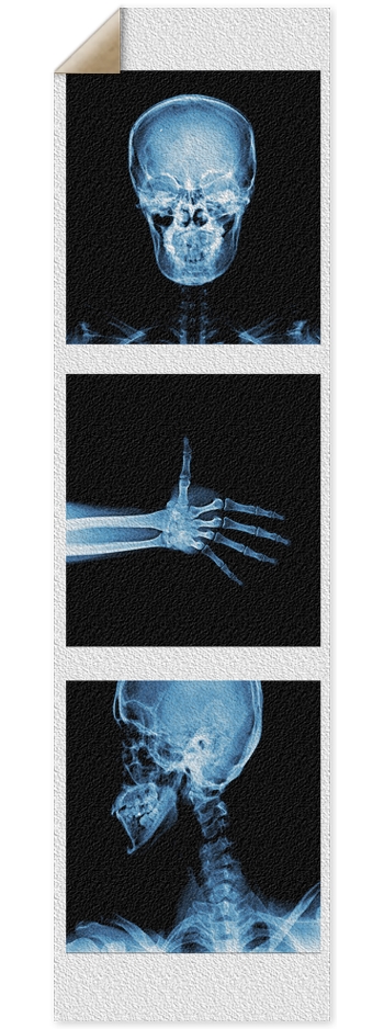 X-Ray