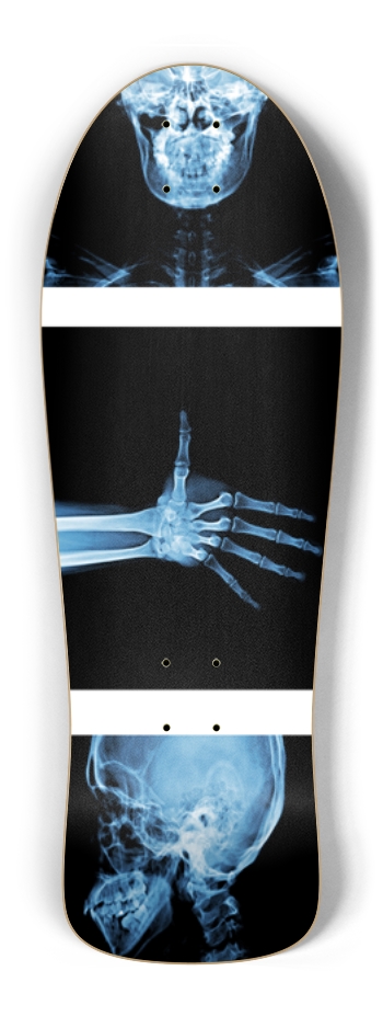 X-Ray