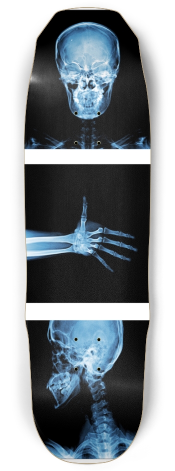 X-Ray