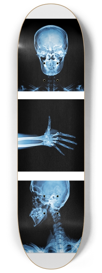 X-Ray